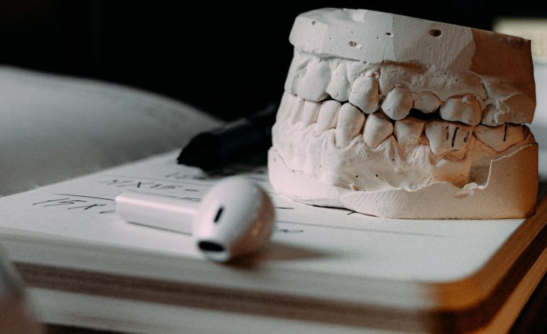 Cementing techniques in Ceramic Restorations