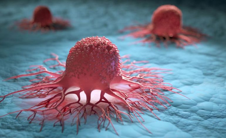 Warning Signs of Cervical Cancer You Shouldn’t Ignore