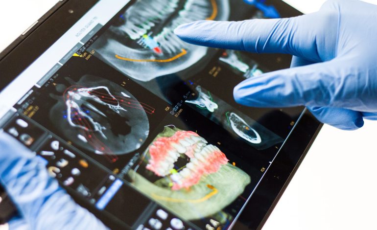 3D Printing in Dentistry