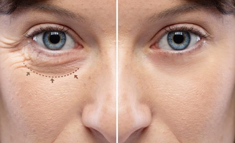 What is the difference between plastic surgery and oculoplastic surgery?