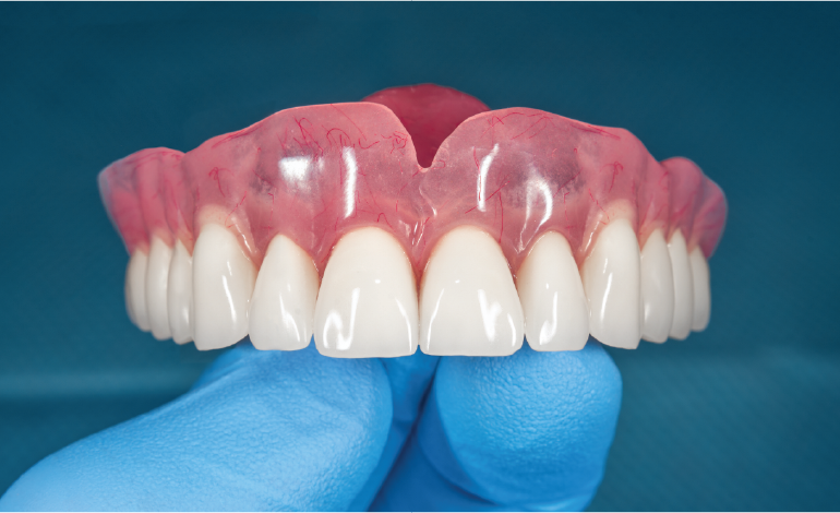 Everything you need to know about Removable Dentures