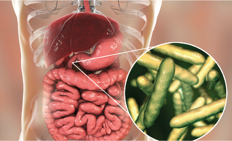 Why Is Whipple’s Disease Still a Challenging Diagnosis
