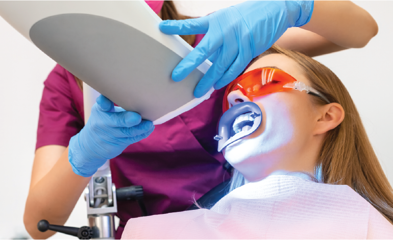 Tooth bleaching procedures and effects