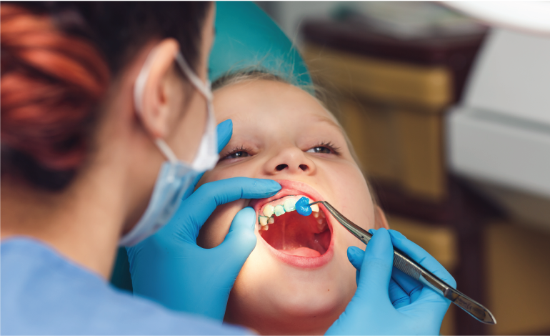 Water fluoridation: Effective prevention for tooth decay