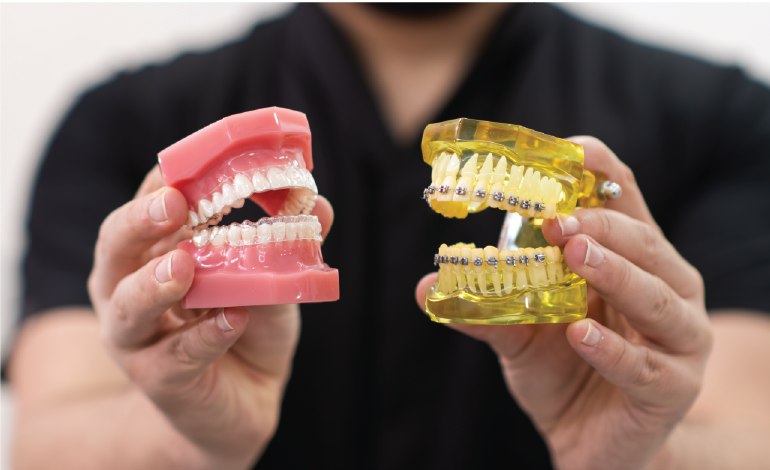 Invisalign Aligners vs. Braces: Which Is Right For Your Smile?
