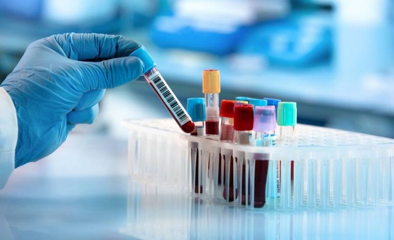 Blood tests: What happens during a blood test and what can the results show?