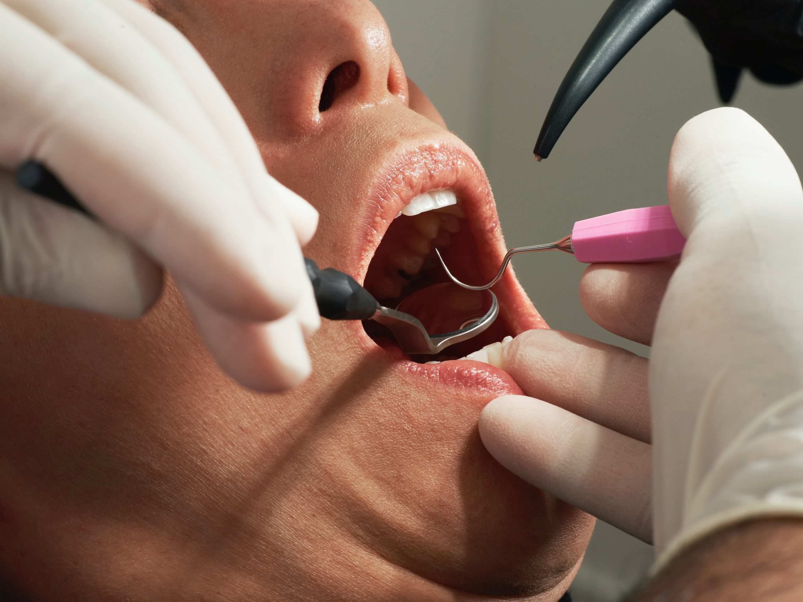 Researchers towards development of biological dental enamel