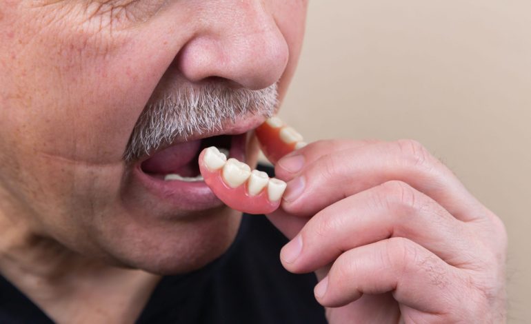 Burning Mouth Syndrome—A Frustrating Problem