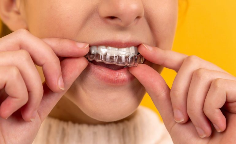 When do you waste unused aligner?