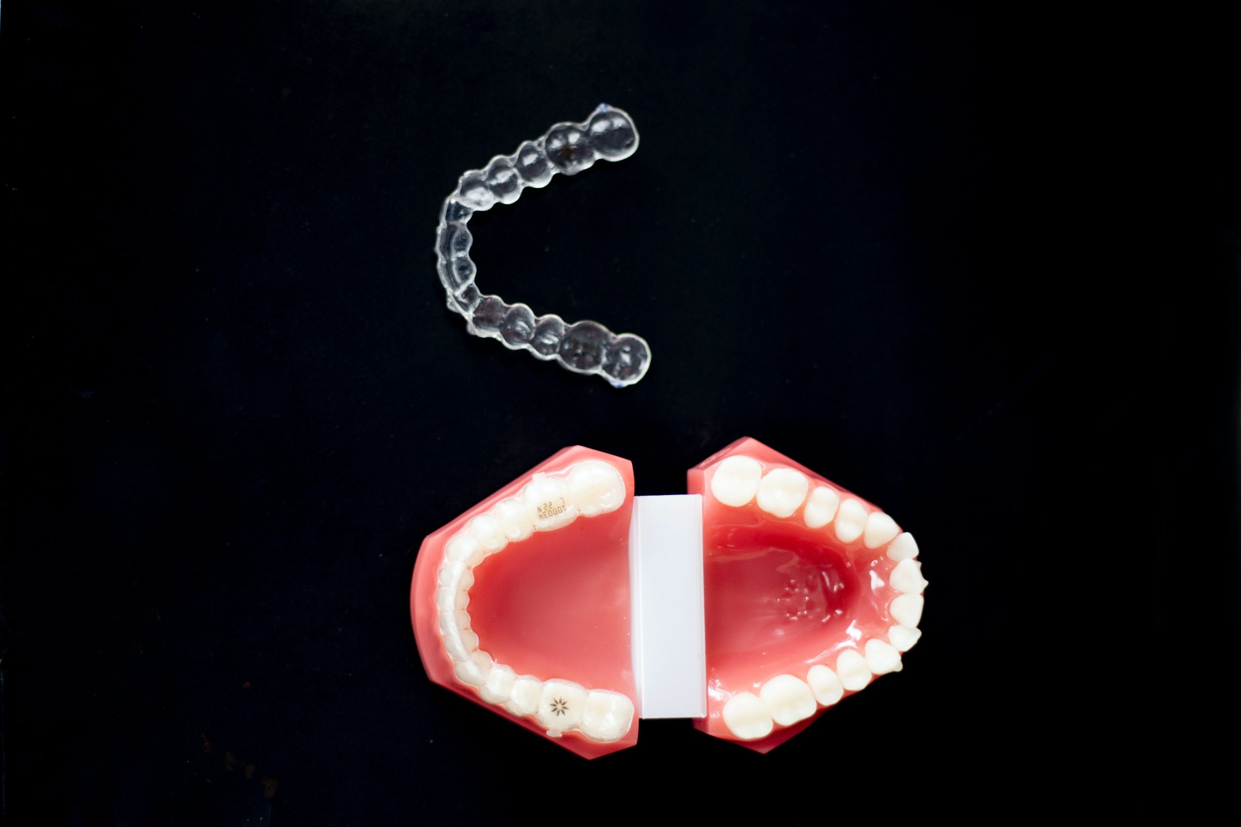 Nocturnal teeth grinding on temporomandibular joints