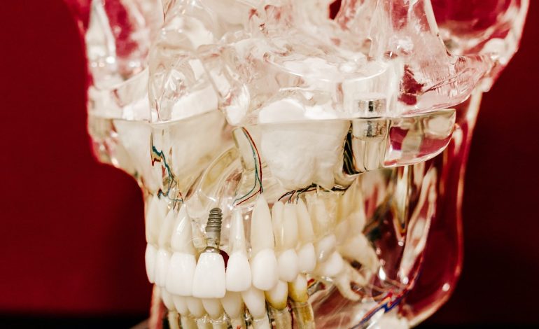Utilizing a Digital Workflow for Implant Treatment Planning