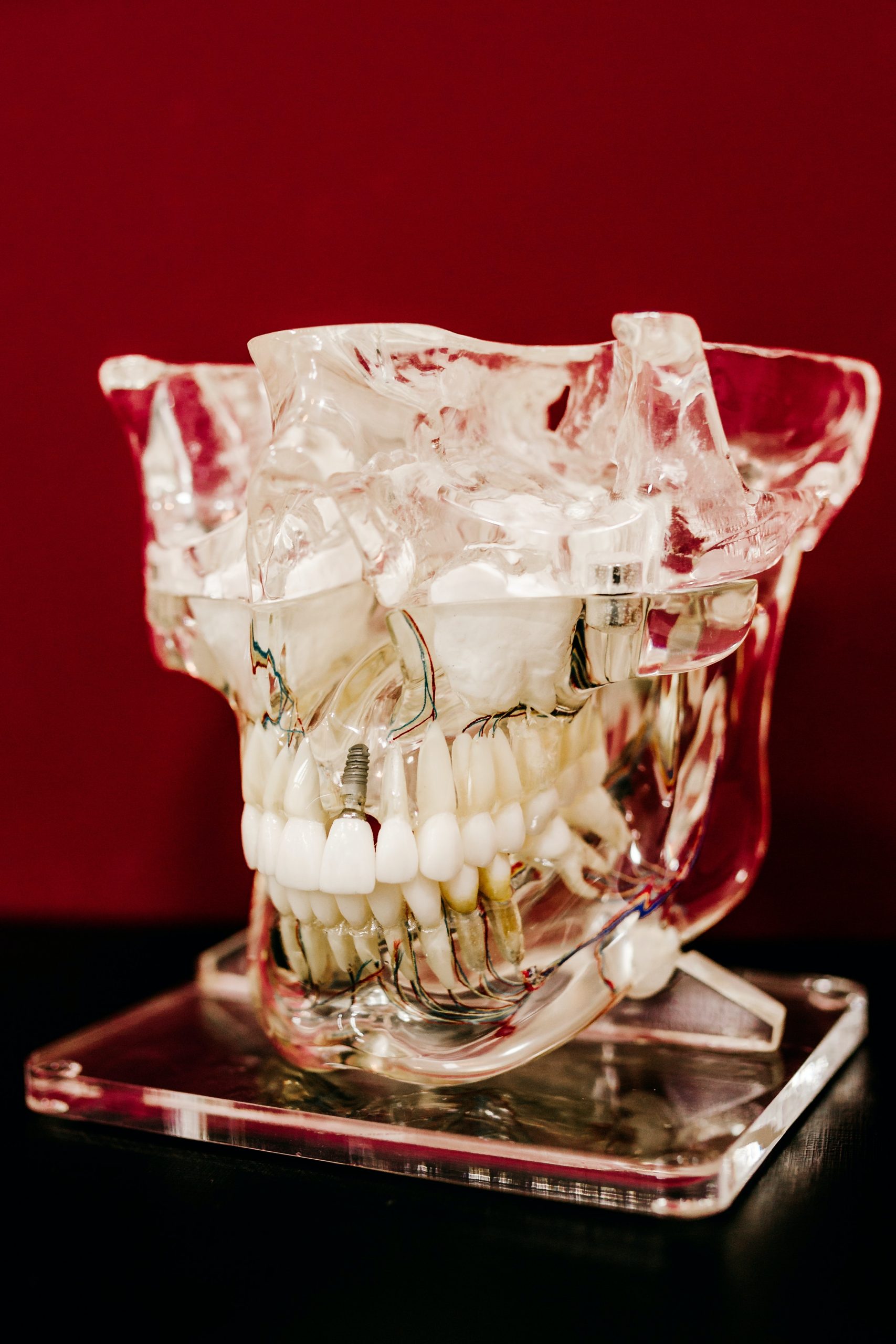Utilizing a Digital Workflow for Implant Treatment Planning