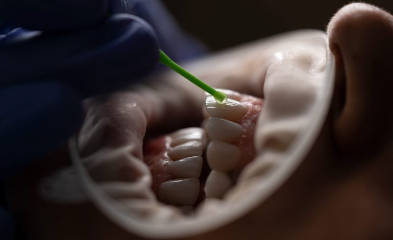 How Minimally Invasive Dentistry Is Cosmetically Enhancing Smiles