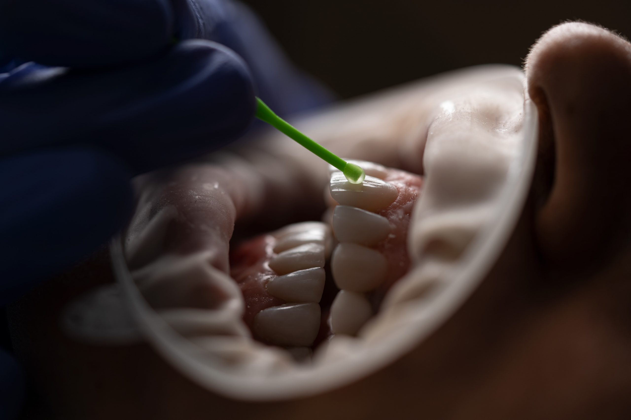 How Minimally Invasive Dentistry Is Cosmetically Enhancing Smiles