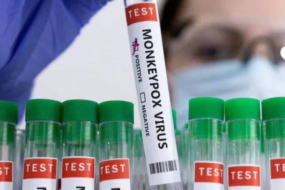 Summarizing the evidence of respiratory transmission of monkey pox