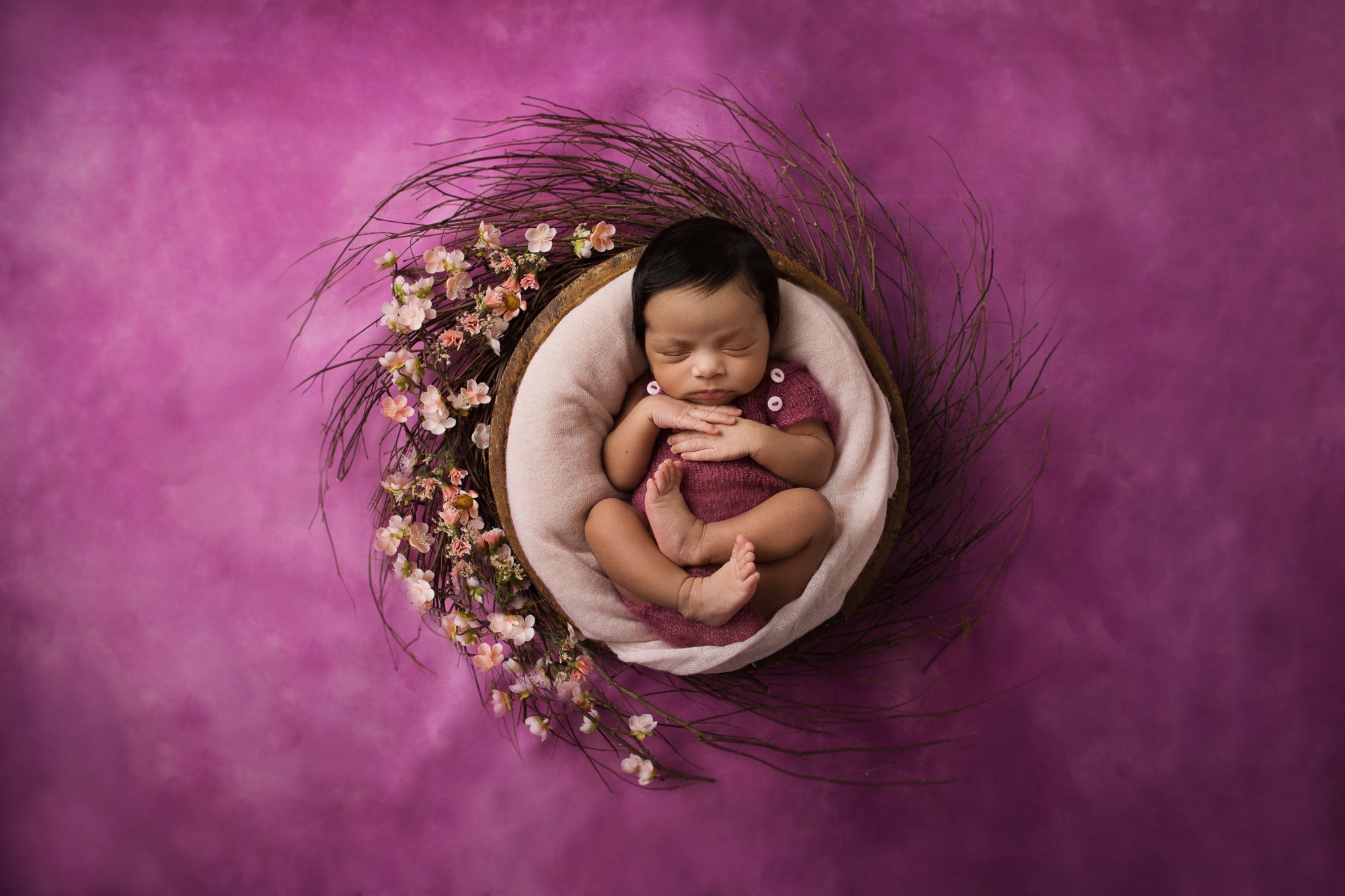 Racial inequities identified in newborn drug testing