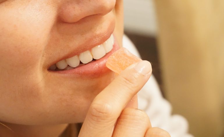 How to fix a gummy smile: here are all your best options.