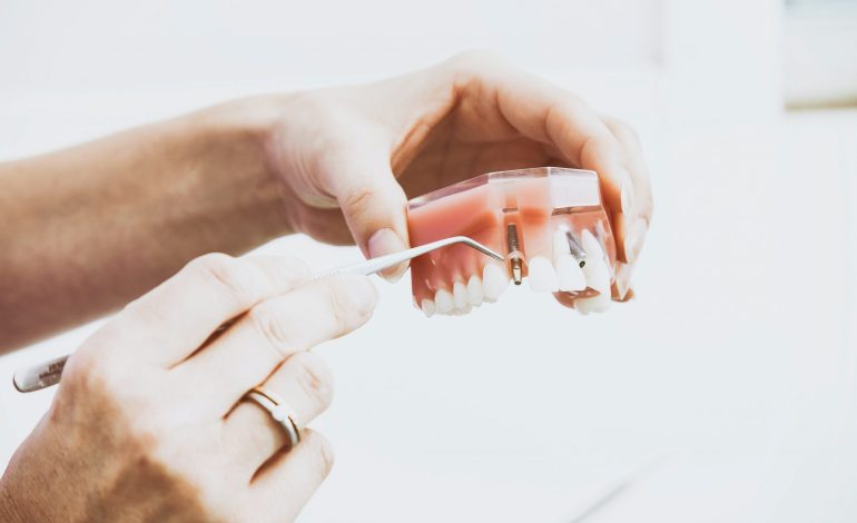Current Approaches to the Concept of Occlusion in Implantology