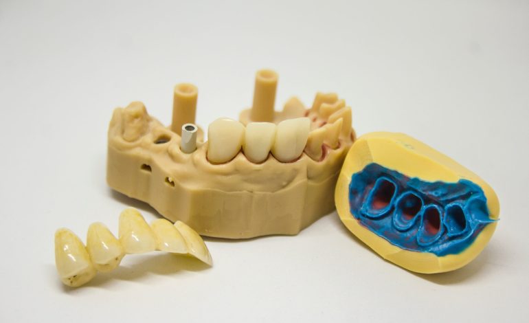 Current Status of Digital Complete Dentures Technology