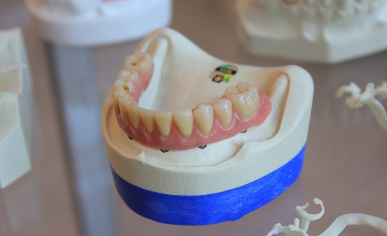 Current Protocols for Resin-Bonded Dental Ceramics