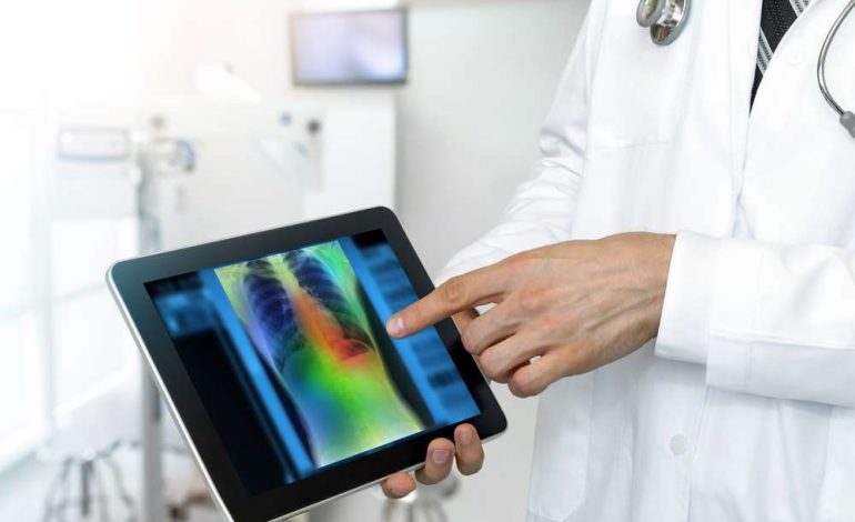 The Current applications and future perspectives of Artificial Intelligence (AI) in lung cancer