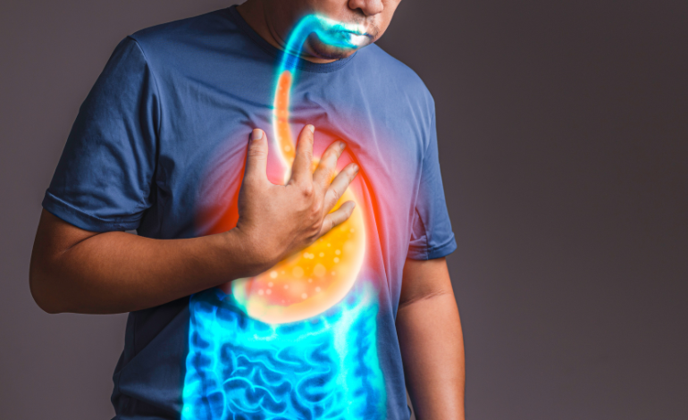 GERD Trends: A Growing Concern Among Younger Populations