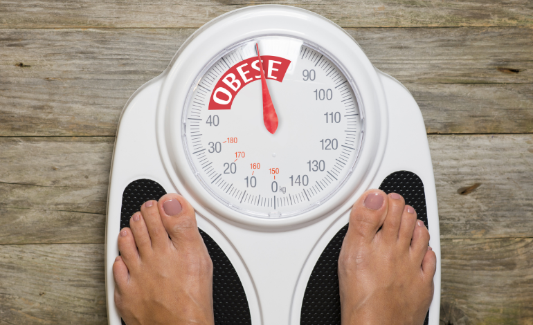 Obesity Linked to Higher Risk of GERD and Related Complications