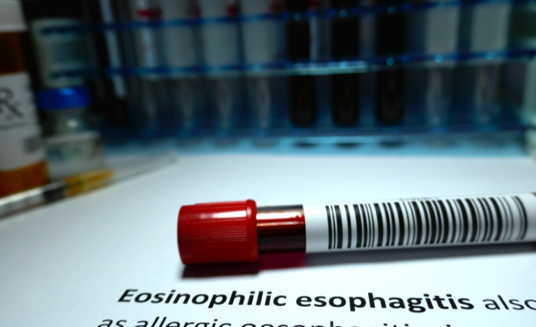 Eosinophilic Esophagitis (EoE): Current Treatments and Emerging Biologic Therapies – A Comprehensive Overview