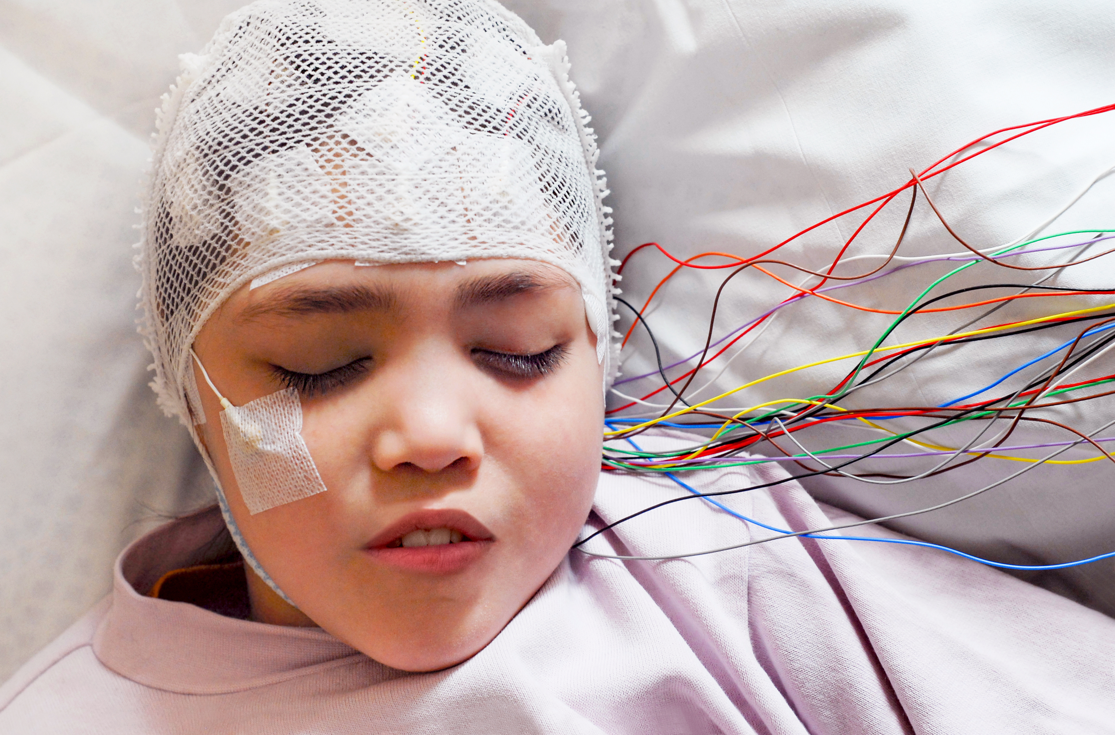 Refractory Seizures or Uncontrolled Epilepsy: Diagnosis and Treatment