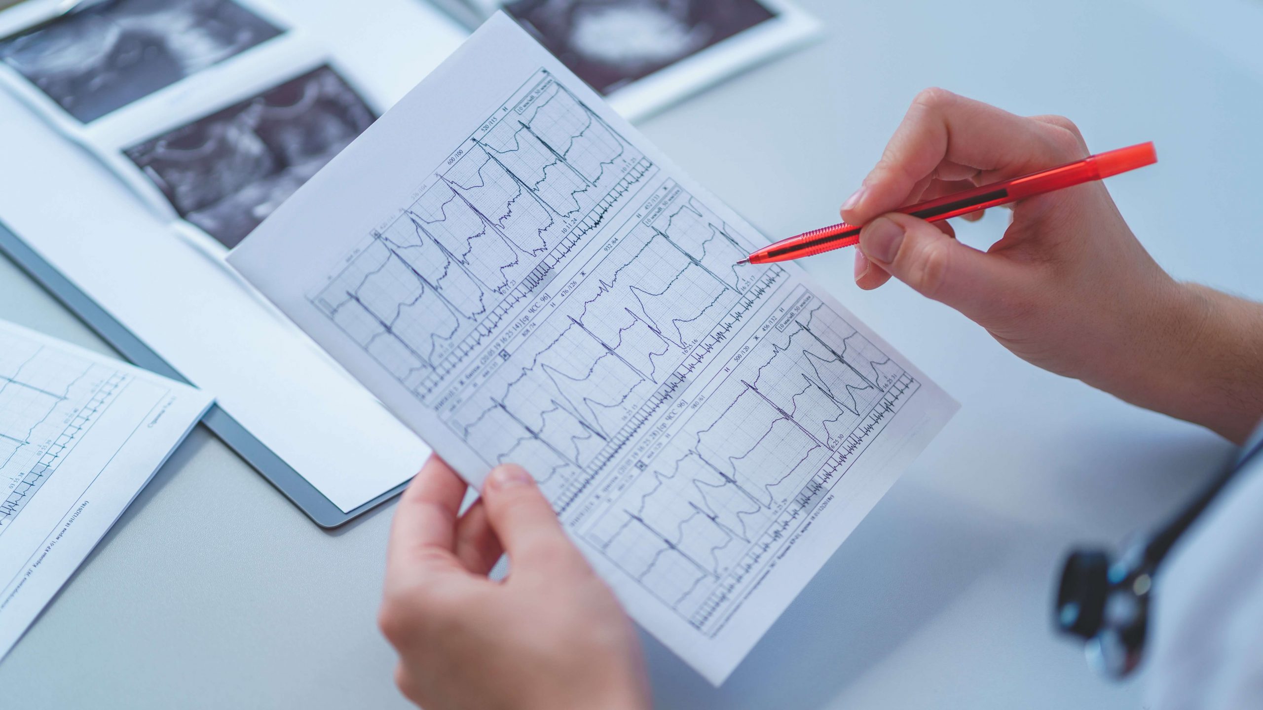 Where Does The Indian Medical Imaging System Stand?