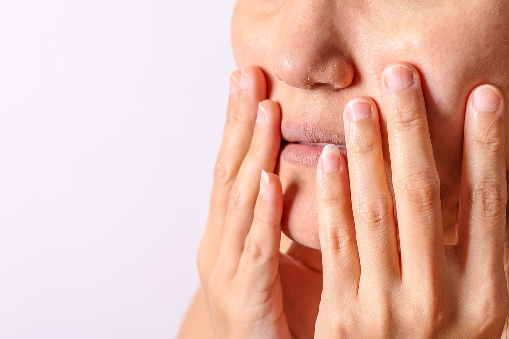 Trends in management of Atopic Dermatitis