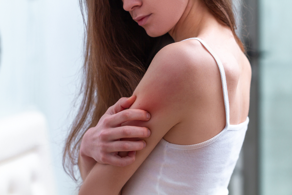 Healthcare Providers Who Can Help You Manage Your Eczema