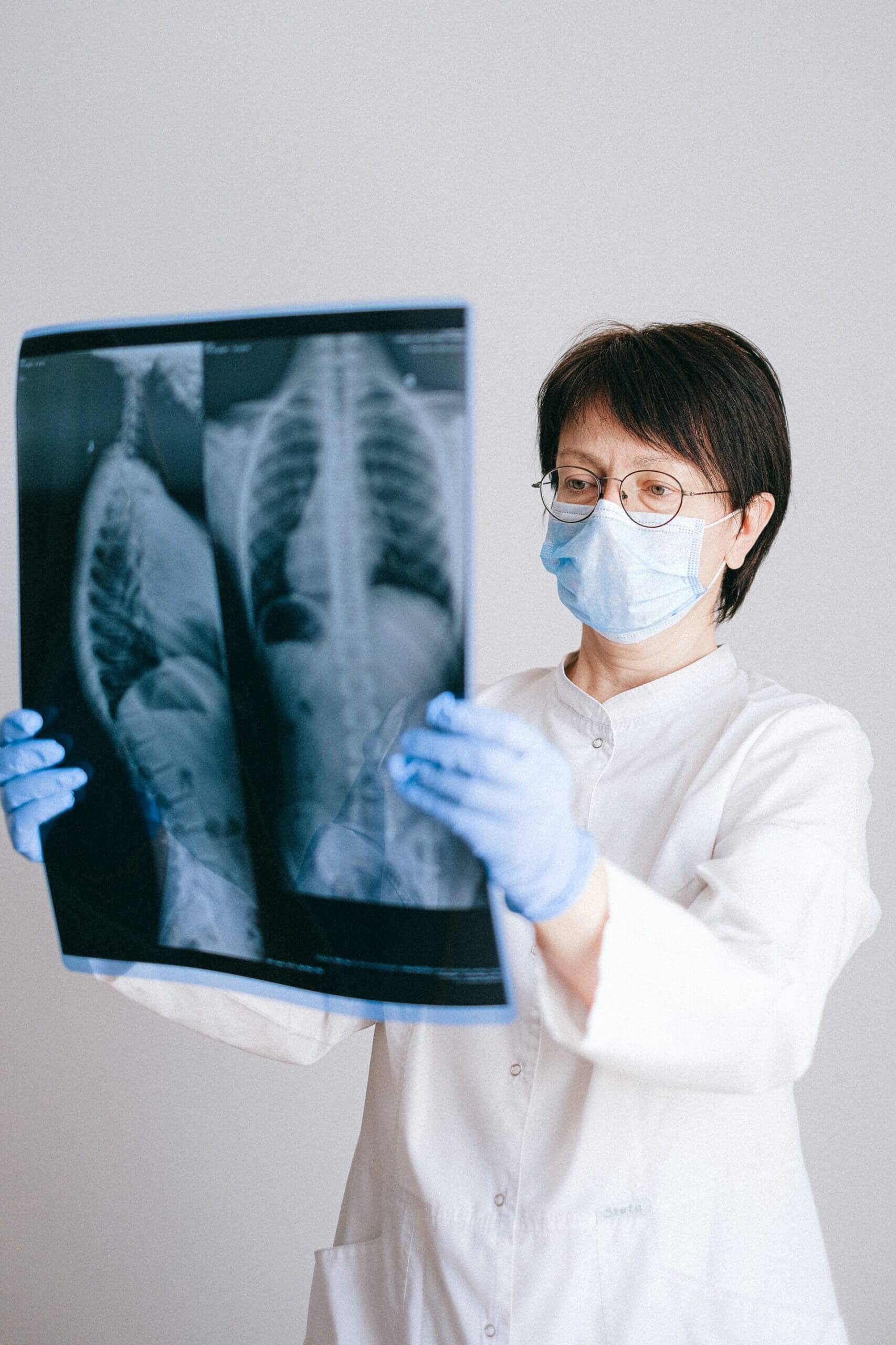 All about pulmonary fibrosis, the fatal disease that can leave one breathless
