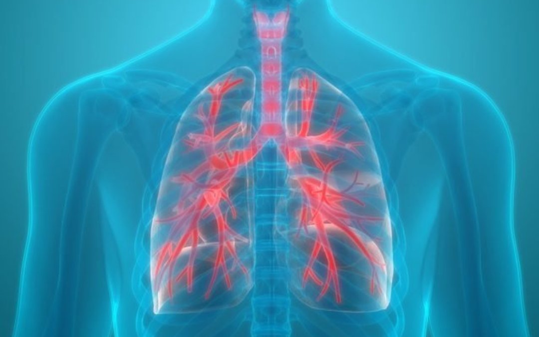 A Rare Etiology of Cystic Lung Disease
