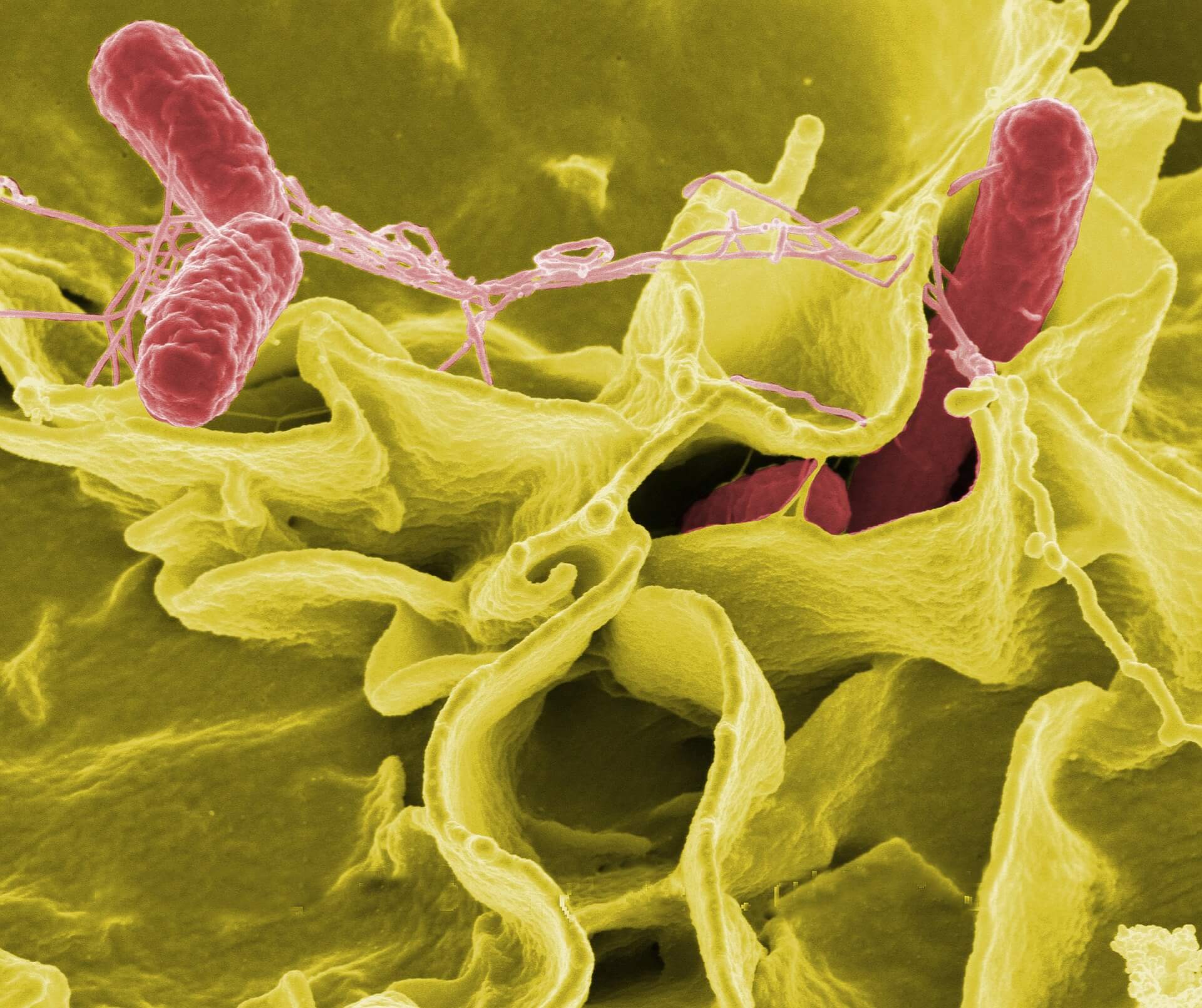 Mycobacterial Cultures in Periprosthetic Joint Infections