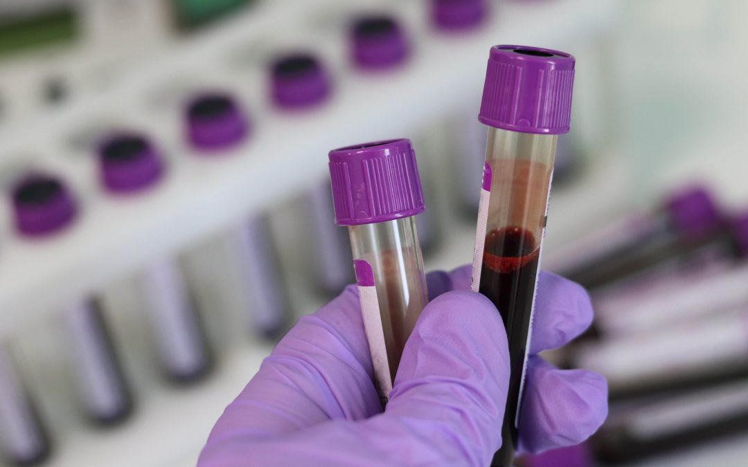 Tissue preservation should be considered as endpoint for geographic atrophy therapies