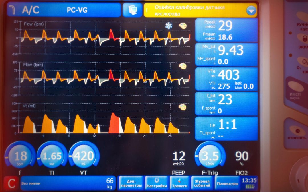 Nutrition in Respiratory Failure