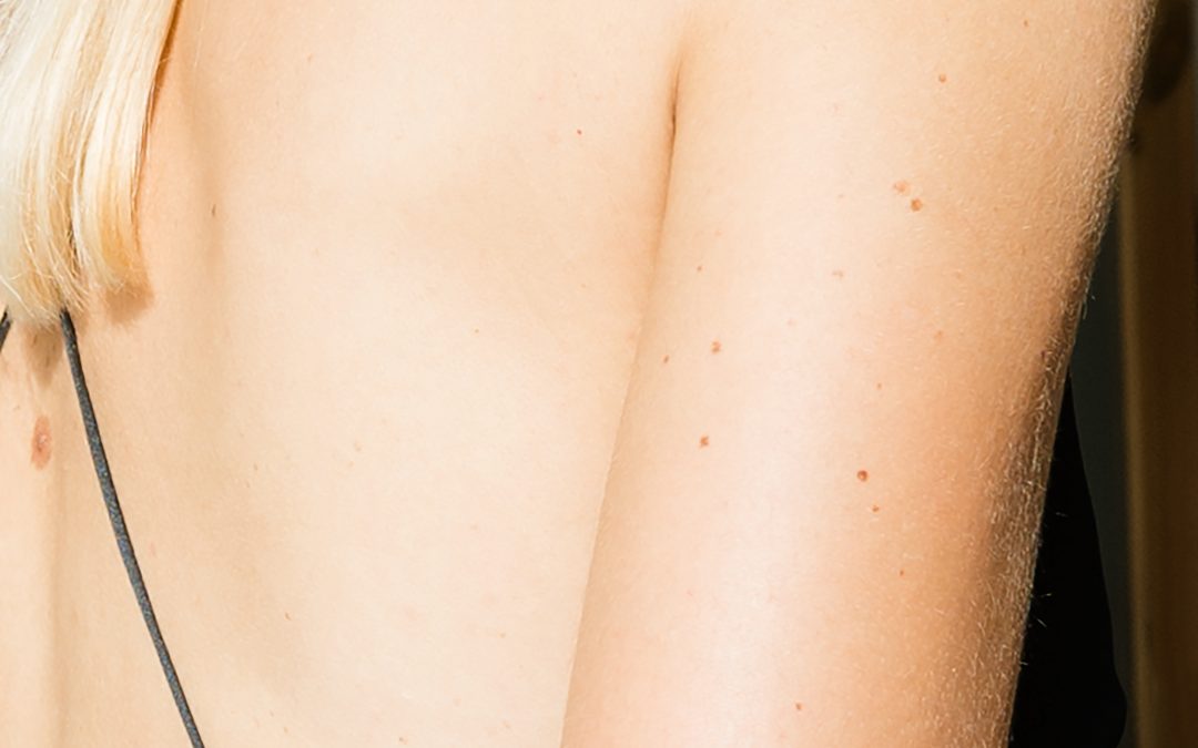 Measles outbreak hits Mumbai