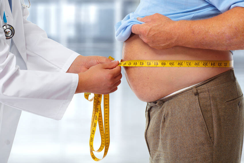 Bariatric surgery – Everything you need to know