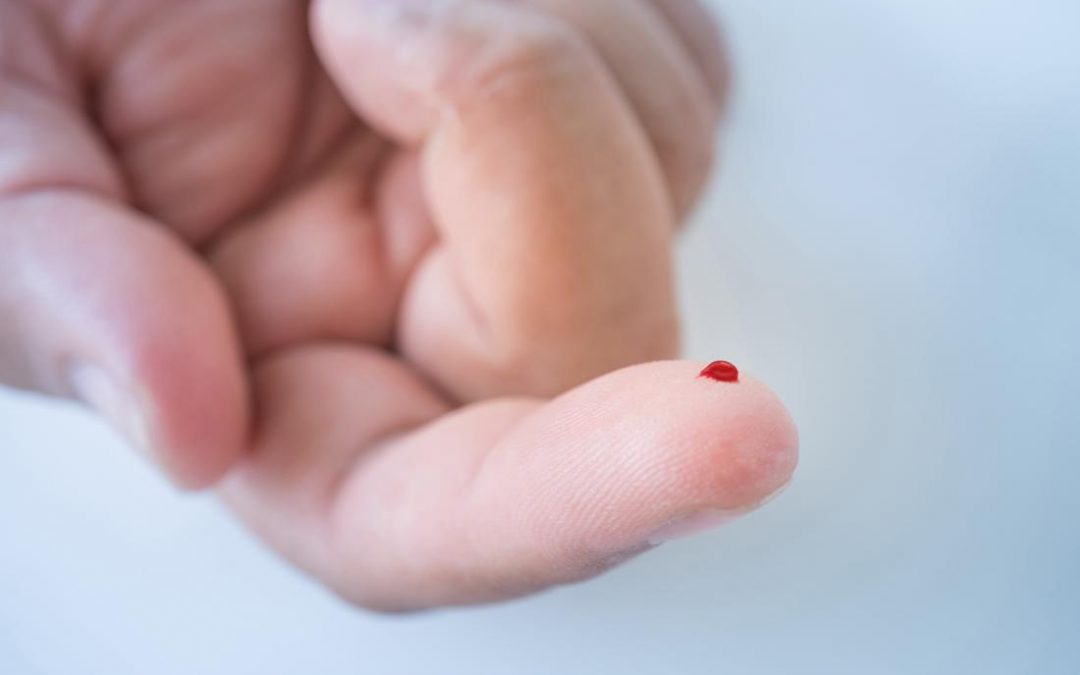 Fingerprick Autologous Blood (FAB) in Severe Dry Eye Disease (DED) (FAB)