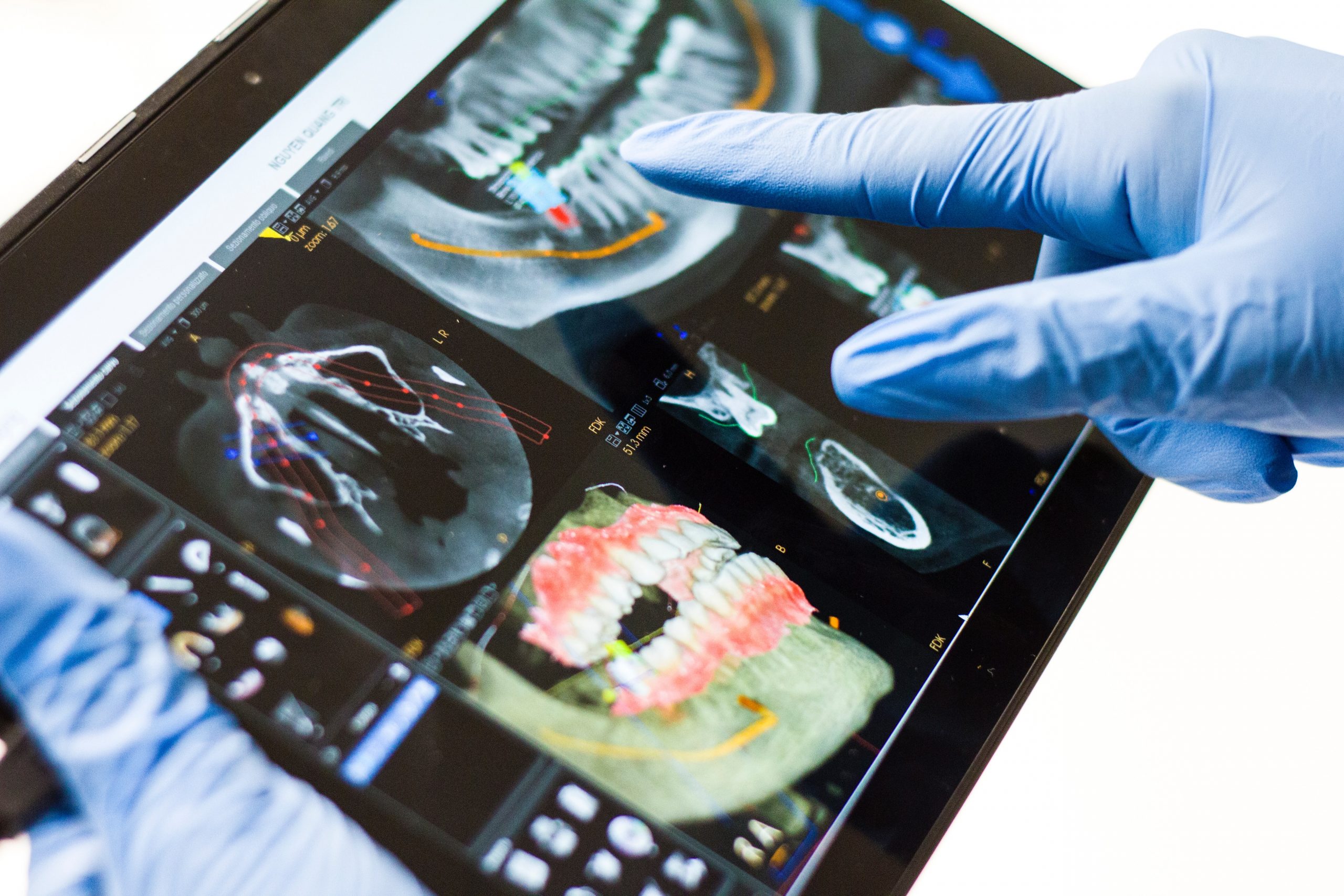 3D Printing in Dentistry