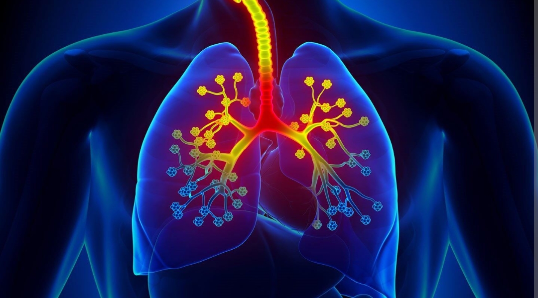 Associations between outdoor air pollutants and non-viral asthma exacerbations