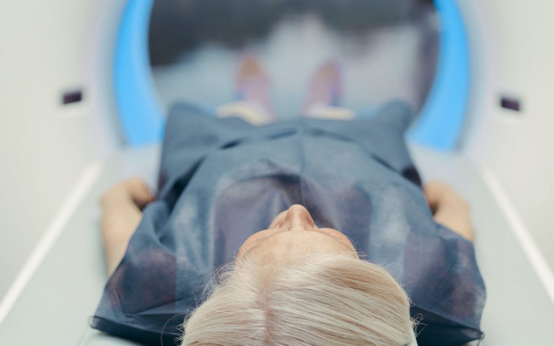 Deep Learning Model May Predict Lung Cancer Risk from a Single CT Scan