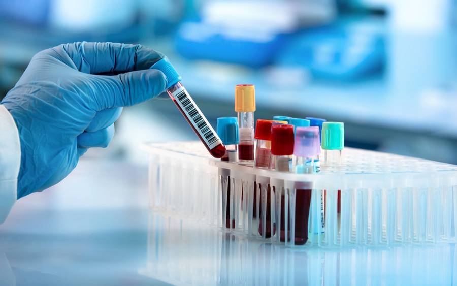 Blood tests: What happens during a blood test and what can the results show?