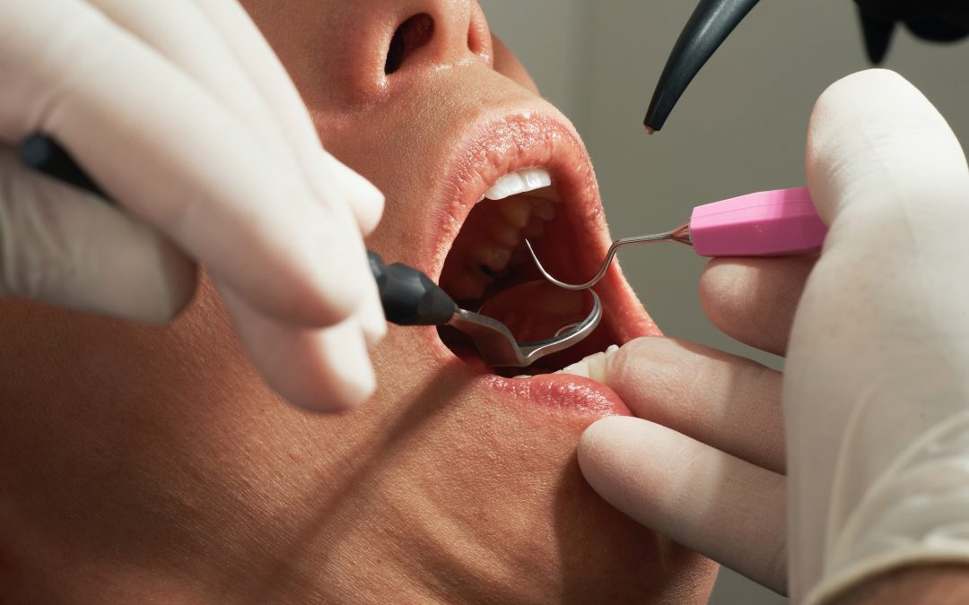 Researchers towards development of biological dental enamel