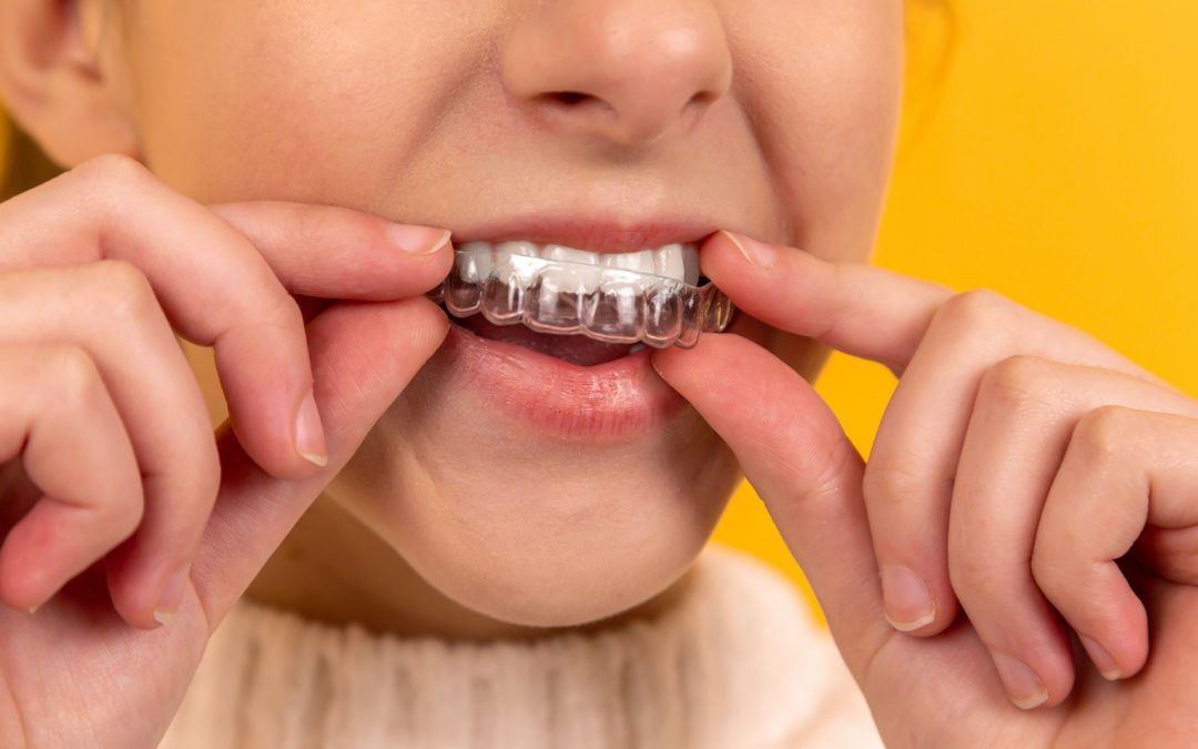 When do you waste unused aligner?