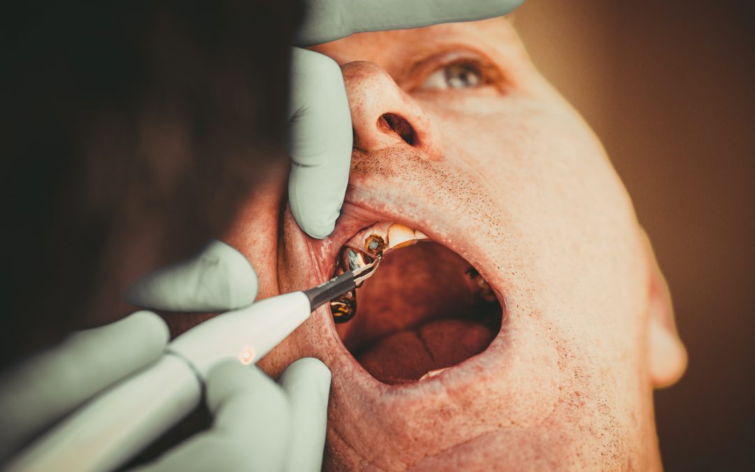 Beyond cavities: Simplifying everyday dentistry