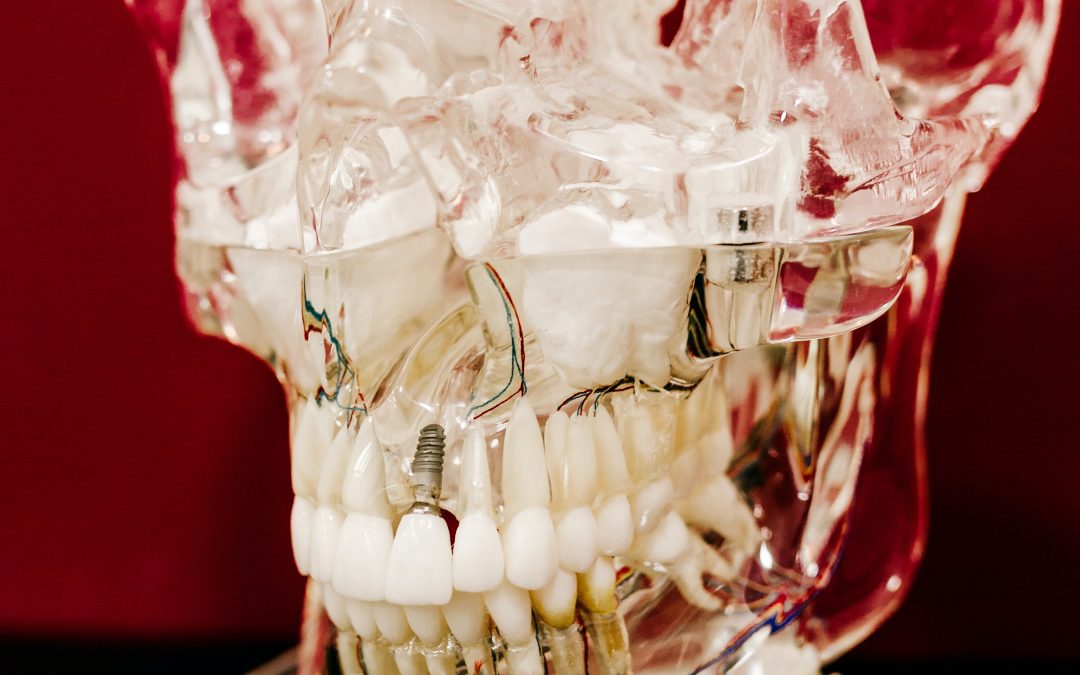 Utilizing a Digital Workflow for Implant Treatment Planning