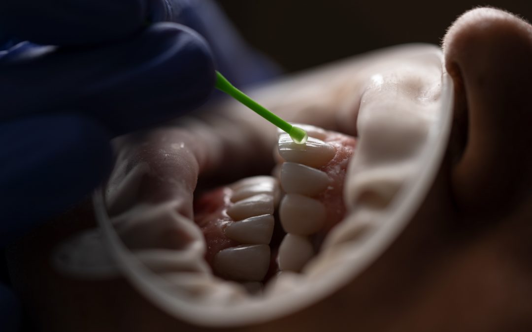 How Minimally Invasive Dentistry Is Cosmetically Enhancing Smiles