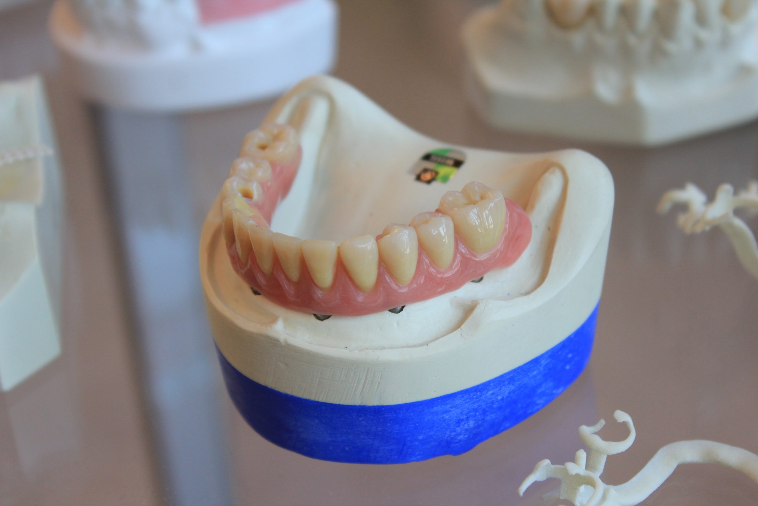 Dental crowns and other extra-coronal restorations